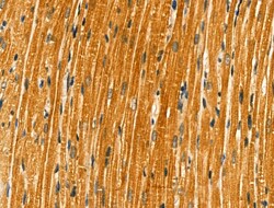 Invitrogen FKRP Polyclonal Antibody 100 &mu;L | Buy Online | Invitrogen&trade; | Fisher Scientific