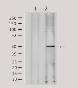 Invitrogen FKRP Polyclonal Antibody 100 &mu;L | Buy Online | Invitrogen&trade; | Fisher Scientific