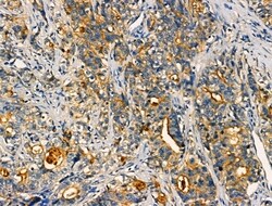 Invitrogen AKAP3 Polyclonal Antibody 100 &mu;L; Unconjugated:Antibodies,