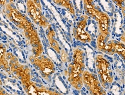 Invitrogen AKAP3 Polyclonal Antibody 100 &mu;L; Unconjugated:Antibodies,