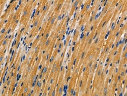 Invitrogen AKAP3 Polyclonal Antibody 100 &mu;L; Unconjugated:Antibodies,