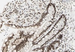 Invitrogen DNA-PK Polyclonal Antibody 100 &mu;L; Unconjugated:Antibodies,