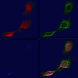 Invitrogen DCP1A Polyclonal Antibody 100 &mu;L; Unconjugated:Antibodies,