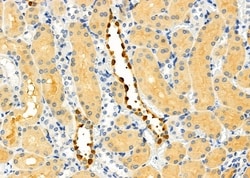 Invitrogen DCP1A Polyclonal Antibody 100 &mu;L; Unconjugated:Antibodies,