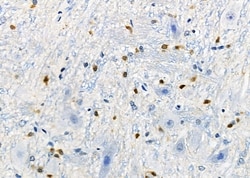 Invitrogen DCP1A Polyclonal Antibody 100 &mu;L; Unconjugated:Antibodies,