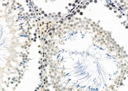 Invitrogen DCP1A Polyclonal Antibody 100 &mu;L; Unconjugated:Antibodies,