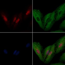 Invitrogen IRX2 Polyclonal Antibody 100 &mu;L; Unconjugated:Antibodies,