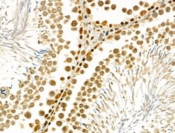 Invitrogen IRX2 Polyclonal Antibody 100 &mu;L; Unconjugated:Antibodies,