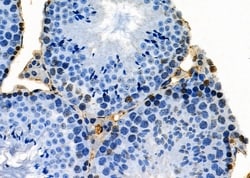 Invitrogen PKNOX2 Polyclonal Antibody 100 &mu;L; Unconjugated:Antibodies,