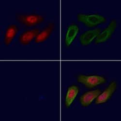 Invitrogen LYK5 Polyclonal Antibody 100 &mu;L; Unconjugated:Antibodies,