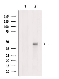Invitrogen LYK5 Polyclonal Antibody 100 &mu;L; Unconjugated:Antibodies,
