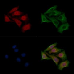 Invitrogen DMPK Polyclonal Antibody 100 &mu;L; Unconjugated:Antibodies,