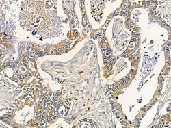 Invitrogen DMPK Polyclonal Antibody 100 &mu;L; Unconjugated:Antibodies,