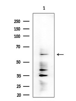 Invitrogen DMPK Polyclonal Antibody 100 &mu;L; Unconjugated:Antibodies,