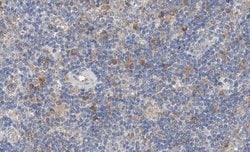 Invitrogen EGR1 Polyclonal Antibody 100 &mu;L; Unconjugated:Antibodies,