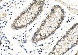 Invitrogen EGR1 Polyclonal Antibody 100 &mu;L; Unconjugated:Antibodies,