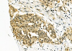 Invitrogen EGR1 Polyclonal Antibody 100 &mu;L; Unconjugated:Antibodies,