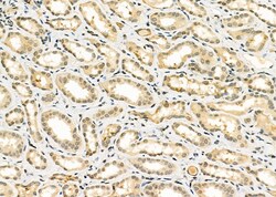 Invitrogen EGR1 Polyclonal Antibody 100 &mu;L; Unconjugated:Antibodies,
