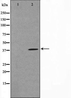 TUSC3 Polyclonal Antibody:Antibodies, Polyclonal