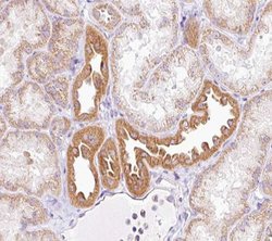 Invitrogen NRIP2 Polyclonal Antibody 100 &mu;L | Buy Online | Invitrogen&trade; | Fisher Scientific