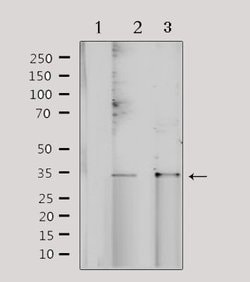 Invitrogen NRIP2 Polyclonal Antibody 100 &mu;L | Buy Online | Invitrogen&trade; | Fisher Scientific