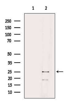 Invitrogen NRIP2 Polyclonal Antibody 100 &mu;L | Buy Online | Invitrogen&trade; | Fisher Scientific