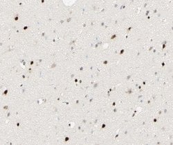 Invitrogen FOXJ3 Polyclonal Antibody 100 &mu;L; Unconjugated:Antibodies,
