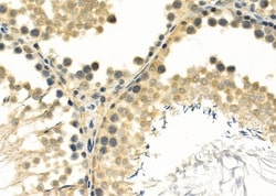 Invitrogen FOXJ3 Polyclonal Antibody 100 &mu;L; Unconjugated:Antibodies,