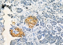 Invitrogen AKAP14 Polyclonal Antibody 100 &mu;L; Unconjugated:Antibodies,