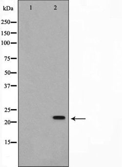 Invitrogen AKAP14 Polyclonal Antibody 100 &mu;L; Unconjugated:Antibodies,
