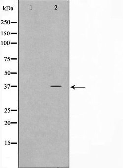 Invitrogen ELOVL4 Polyclonal Antibody 100 &mu;L; Unconjugated:Antibodies,