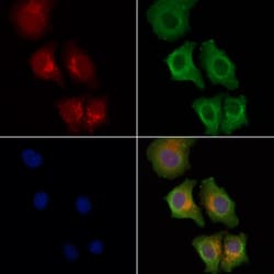 Invitrogen EphA7 Polyclonal Antibody 100 &mu;L; Unconjugated:Anticuerpos