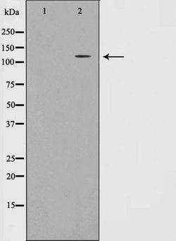 Invitrogen EphA7 Polyclonal Antibody 100 &mu;L; Unconjugated:Anticuerpos