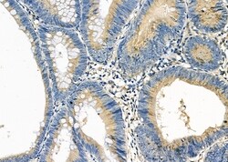 Invitrogen CYP2B6 Polyclonal Antibody 100 &mu;L; Unconjugated:Antibodies,