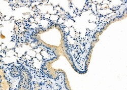 Invitrogen CYP2B6 Polyclonal Antibody 100 &mu;L; Unconjugated:Antibodies,