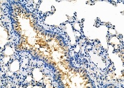 Invitrogen CYP2B6 Polyclonal Antibody 100 &mu;L; Unconjugated:Antibodies,