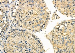 Invitrogen CYP2B6 Polyclonal Antibody 100 &mu;L; Unconjugated:Antibodies,