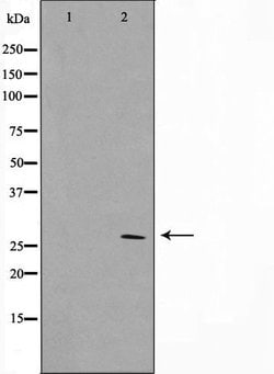Invitrogen HOXD12 Polyclonal Antibody 100 &mu;L; Unconjugated:Antibodies,