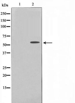 Invitrogen TBX22 Polyclonal Antibody 100 &mu;L | Buy Online | Invitrogen&trade; | Fisher Scientific