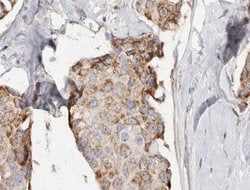 Invitrogen PHLDA2 Polyclonal Antibody 100 &mu;L | Buy Online | Invitrogen&trade; | Fisher Scientific