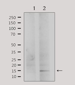 Invitrogen PHLDA2 Polyclonal Antibody 100 &mu;L | Buy Online | Invitrogen&trade; | Fisher Scientific