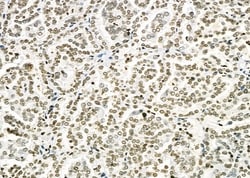 Invitrogen ERGIC3 Polyclonal Antibody 100 &mu;L; Unconjugated:Antibodies,