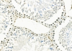 Invitrogen ERGIC3 Polyclonal Antibody 100 &mu;L; Unconjugated:Antibodies,