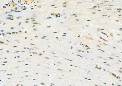 Invitrogen ERGIC3 Polyclonal Antibody 100 &mu;L; Unconjugated:Antibodies,