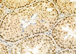 Invitrogen ERGIC3 Polyclonal Antibody 100 &mu;L; Unconjugated:Antibodies,