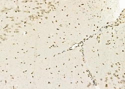 Invitrogen ERGIC3 Polyclonal Antibody 100 &mu;L; Unconjugated:Antibodies,