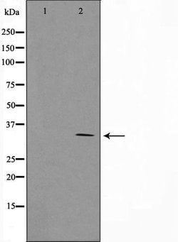 Invitrogen SURF1 Polyclonal Antibody 100 &mu;L | Buy Online | Invitrogen&trade; | Fisher Scientific