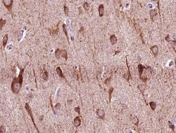 Invitrogen ZNF287 Polyclonal Antibody 100 &mu;L; Unconjugated:Antibodies,