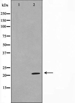 Invitrogen TPD52L2 Polyclonal Antibody 100 &mu;L; Unconjugated:Antibodies,