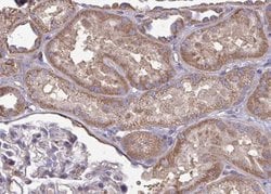 Invitrogen CYP2J2 Polyclonal Antibody 100 &mu;L; Unconjugated:Antibodies,